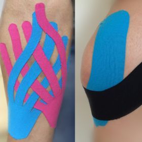 Кинезиологичен тейпинг